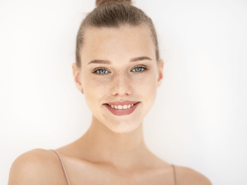 acne scars laser treatment Lawrence MA 01843