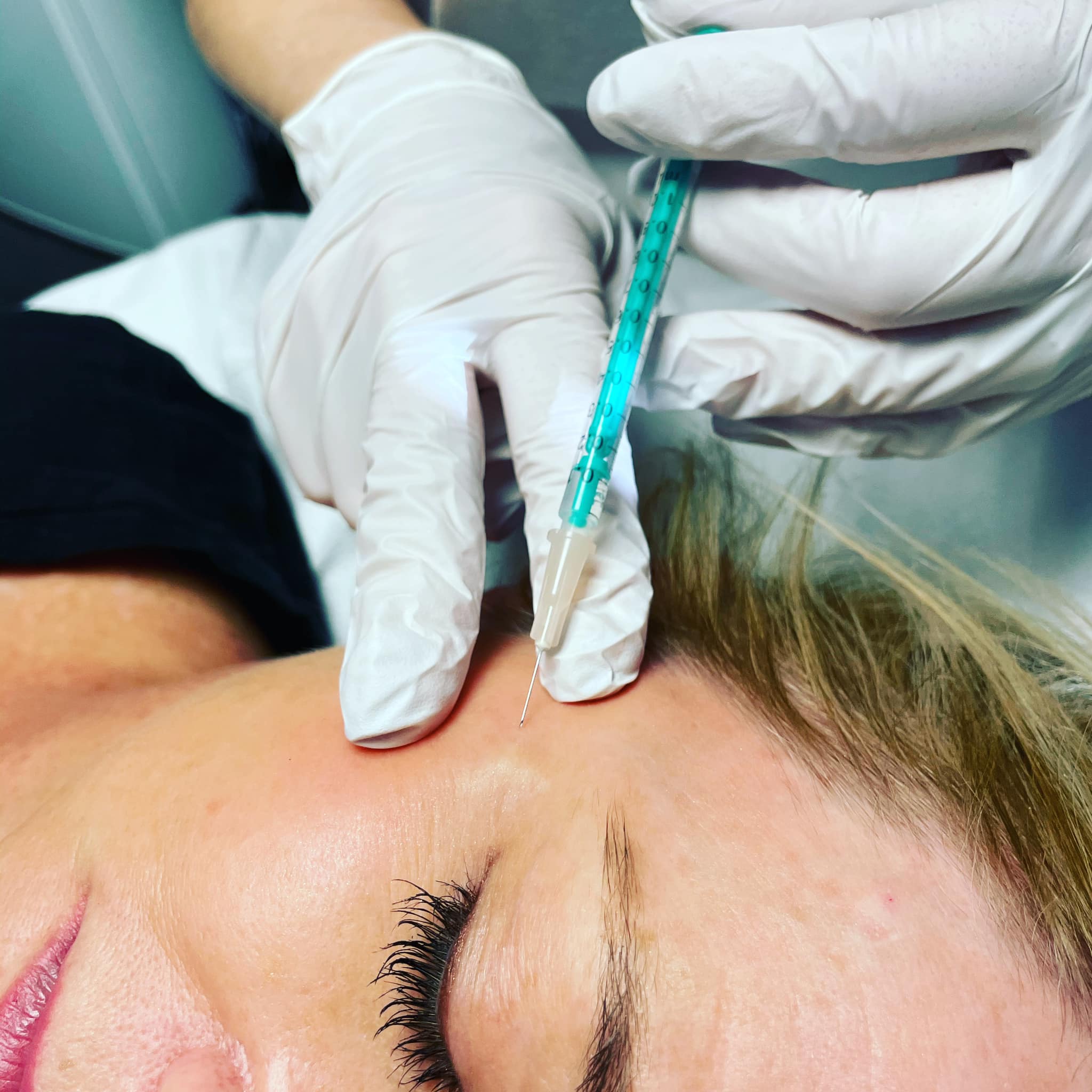 What are aesthetic treatments?