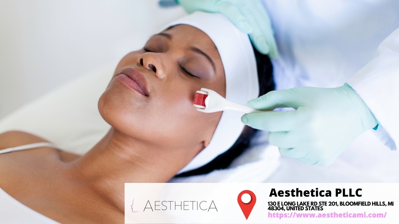 Pdo Threadlift Near me Bloomfield Hills, Michigan