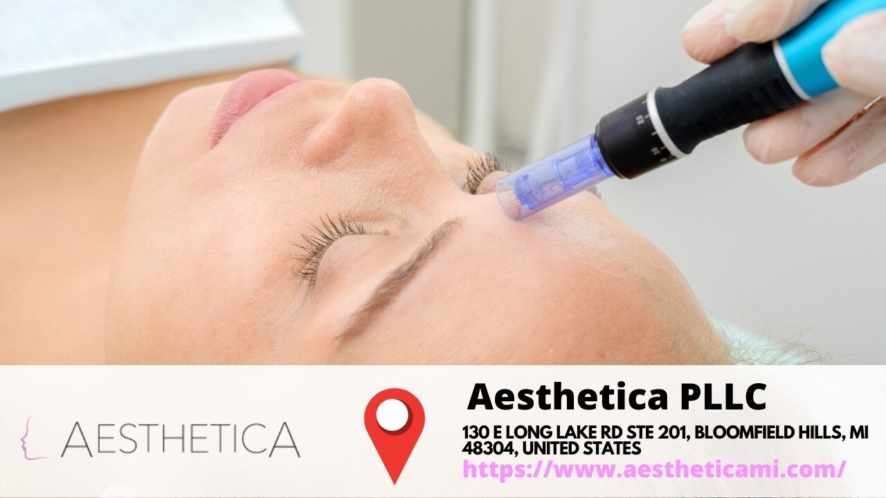 Non- Surgical Facelift Pdo Thread Lift Nearme in Bloomfield Hills, MI