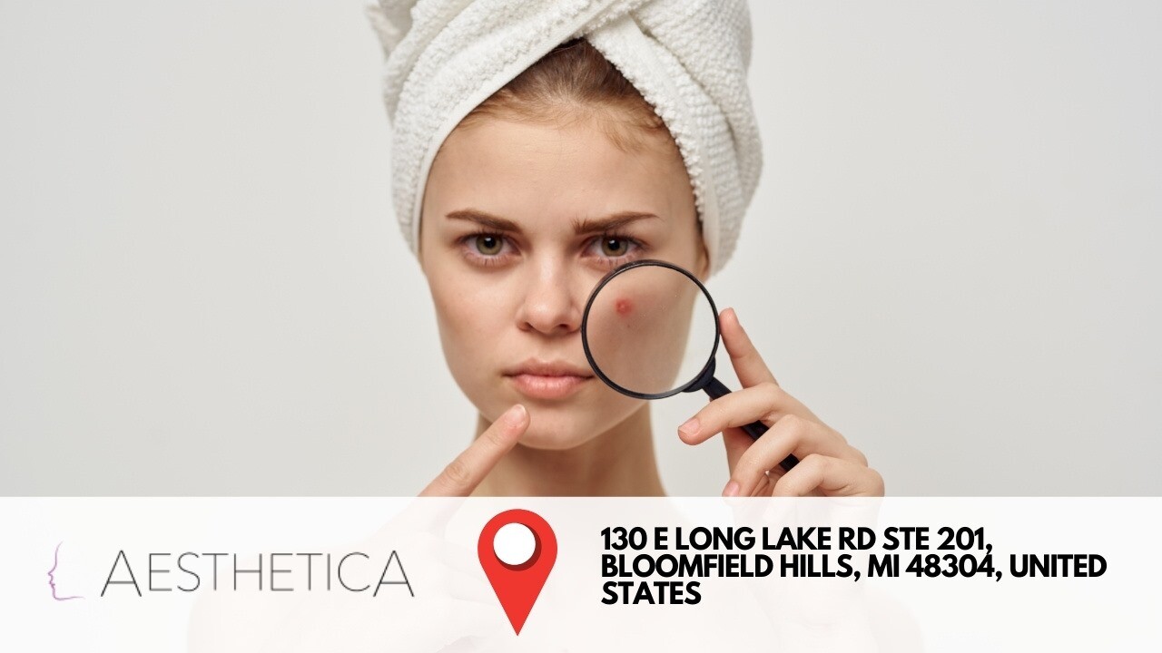 How Nonsurgical Face-lifts Work With Pdo Threads Near me in Bloomfield Hills in Michigan