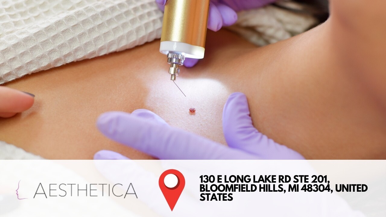 Pdo Thread Lift Near me Bloomfield Hills, MI
