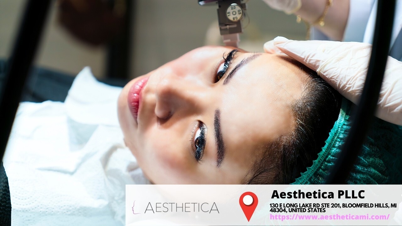 Non- Surgical Facelift Pdo Thread Lift Nearme Bloomfield Hills, MI