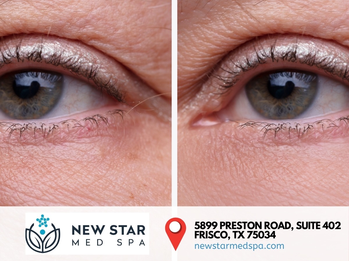 non invasive body sculpting Frisco TX