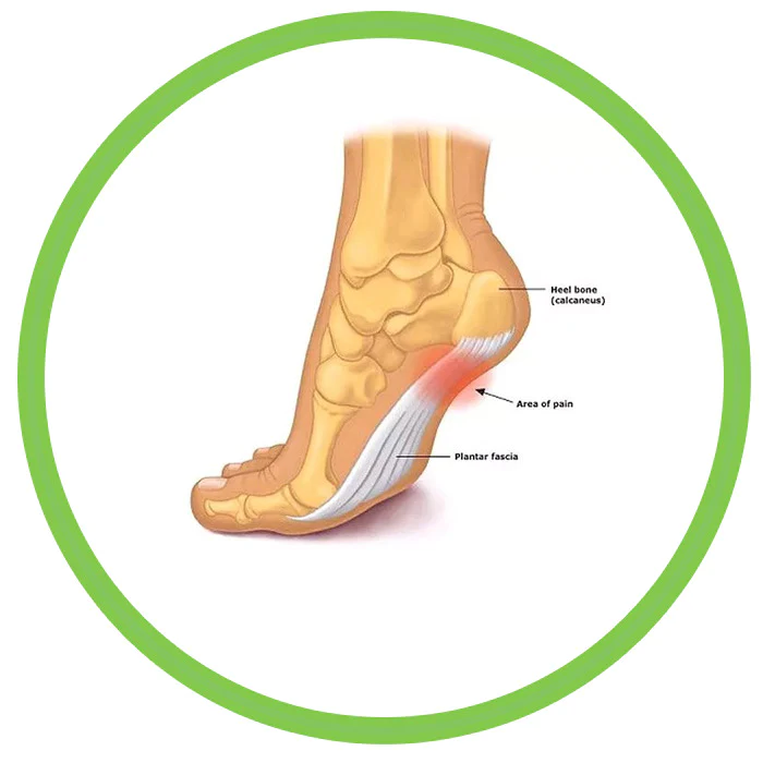 BEST WALKING SHOES FOR FLAT FEET AND PLANTAR FASCIITIS