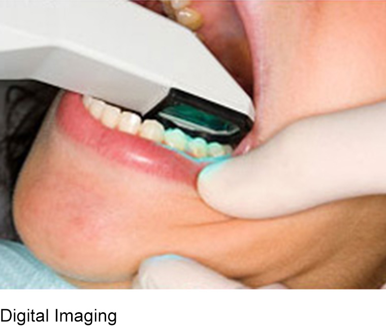 same day dental implants 2022
