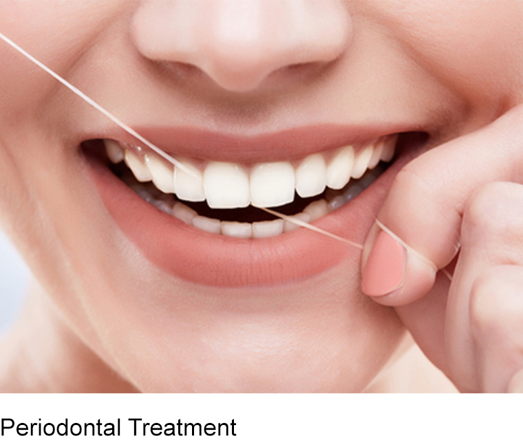 dental implants explained