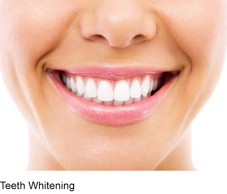 can dental implants be done same day