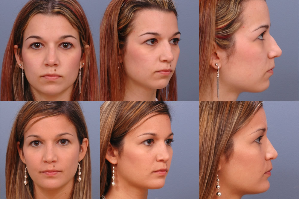 cosmetic surgery in Tampa