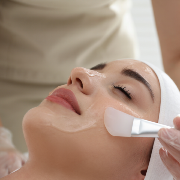 chemical peels services