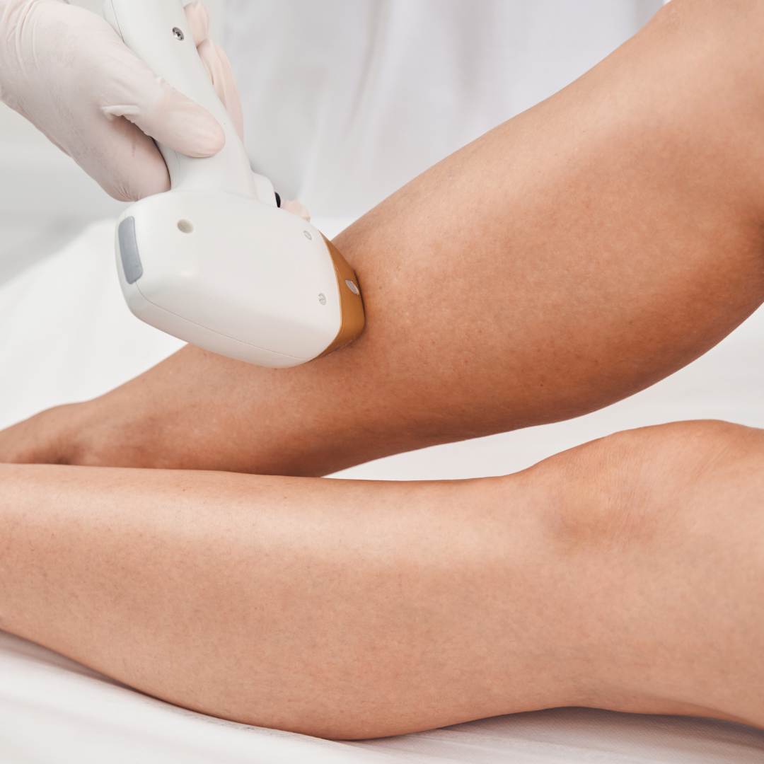 M LASER HAIR REMOVAL - Escape Beauty