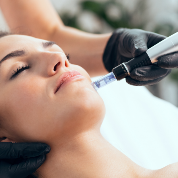 microneedling services