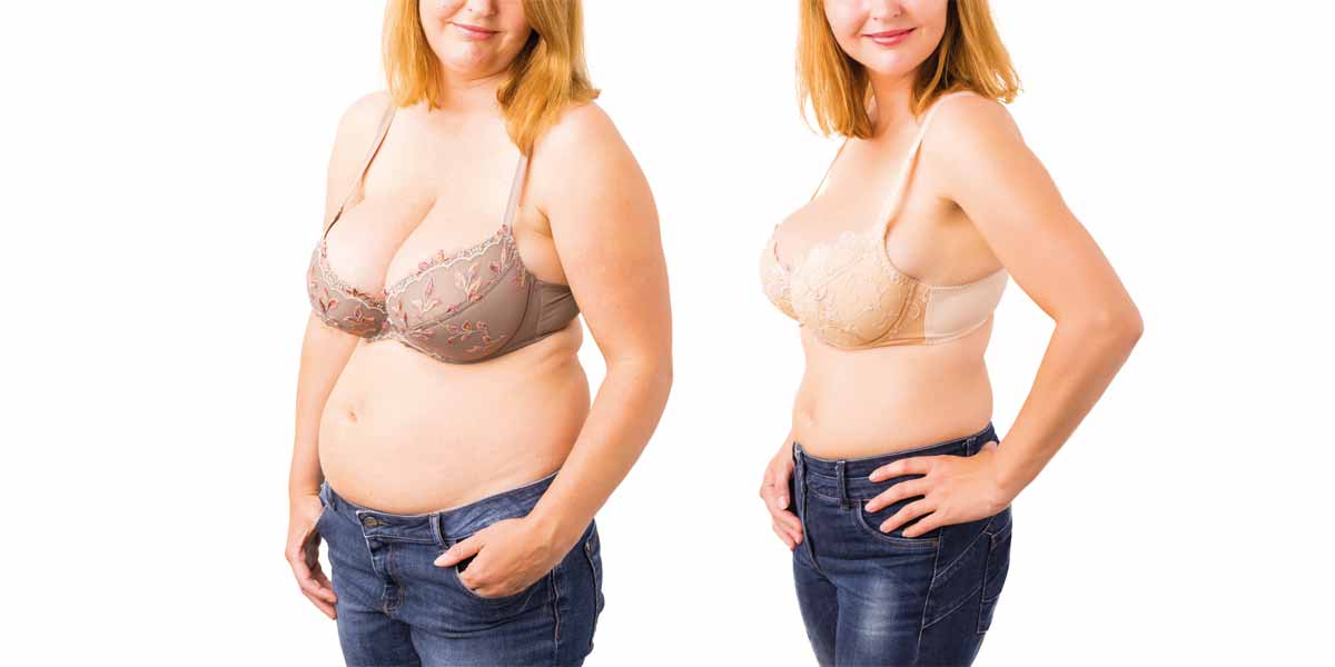 types of weight loss surgery comparison