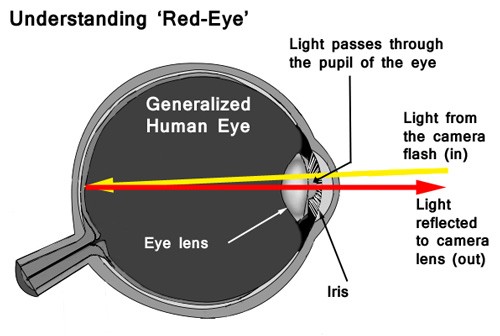 Red Eye Graphic