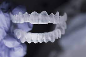 braces and invisalign