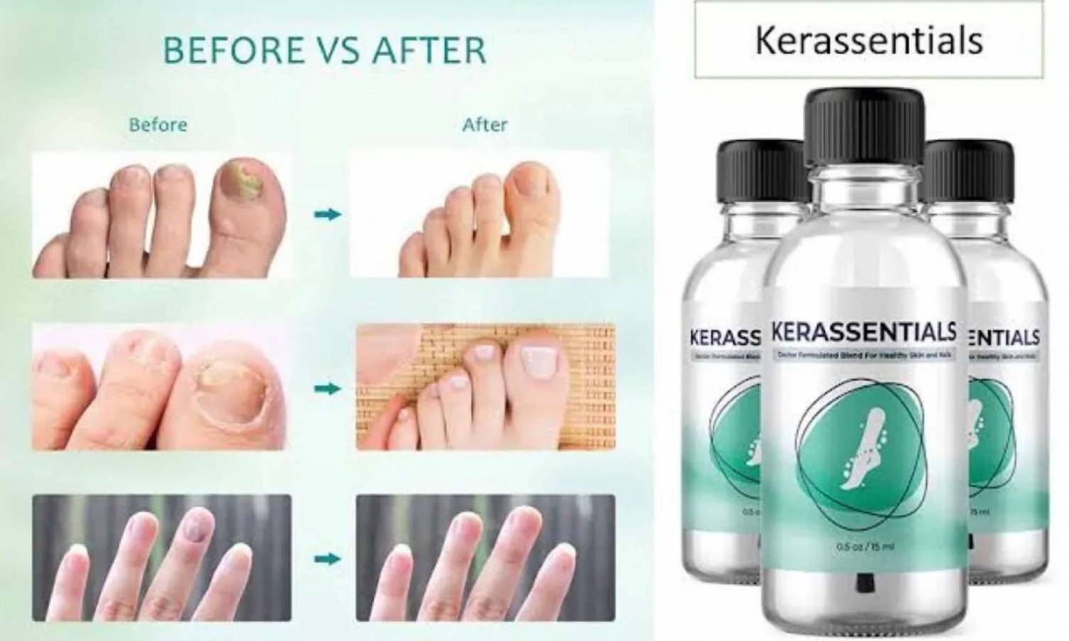 What Is Your Review On Kerassentials Oil 2022