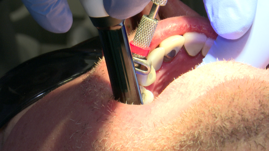 Free Dental Care Day Highlights Families Struggle To Afford