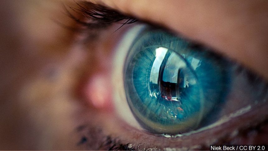 Contact lenses