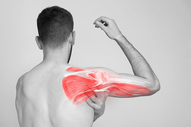 3D animation for personal injury cases