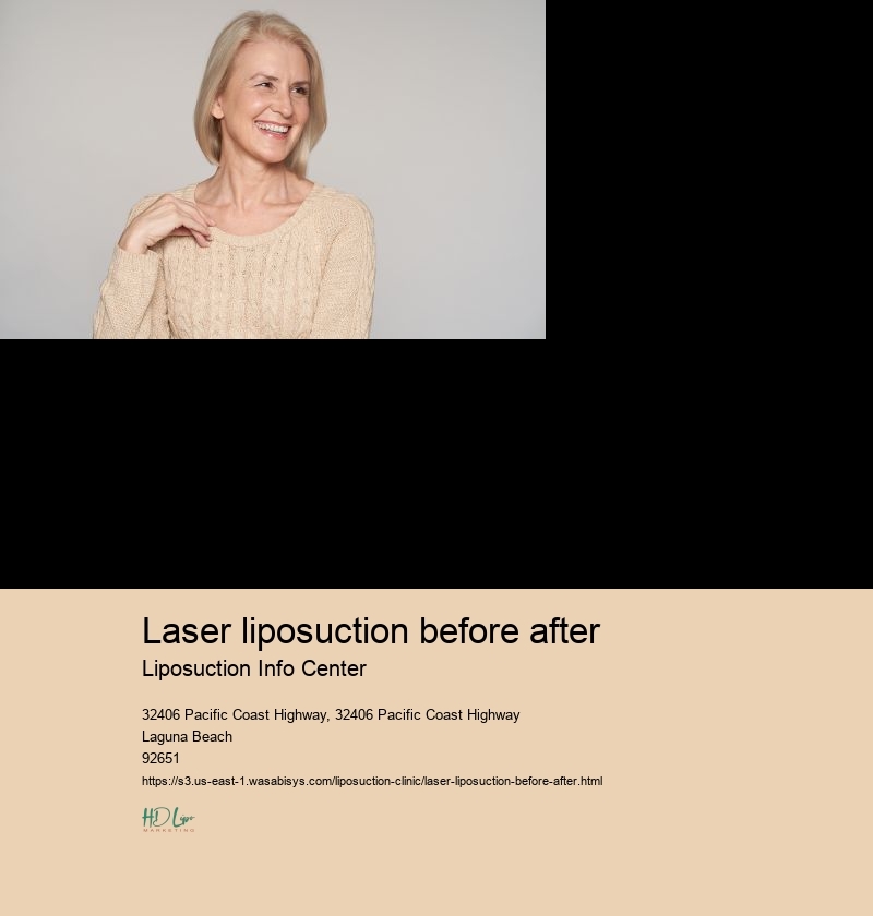 laser liposuction before after