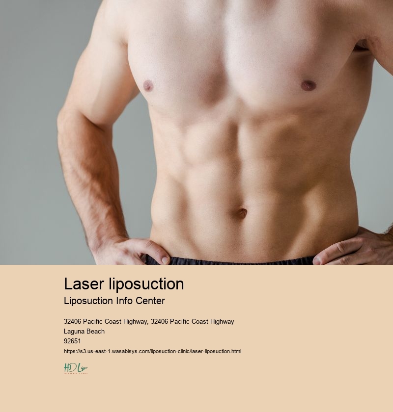 laser liposuction