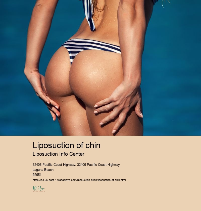 liposuction of chin