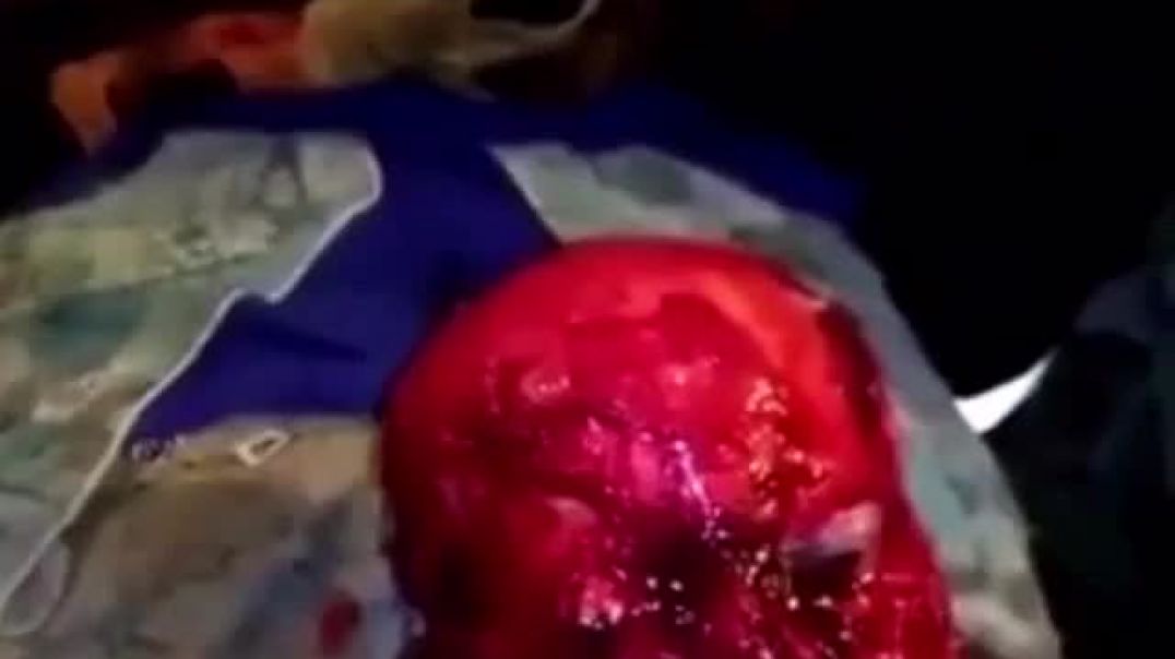 ⁣Woman With Skinned Face