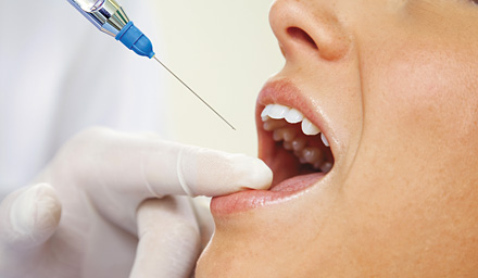 fedvip dental