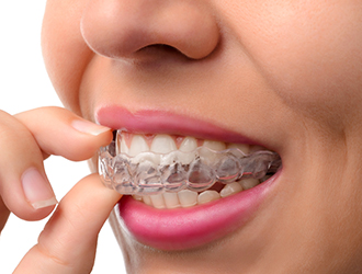 walk in dental clinic near me
