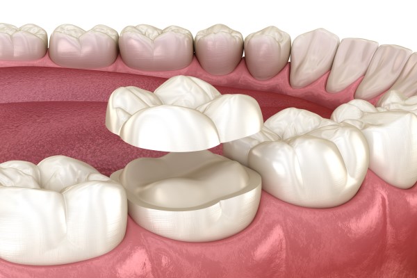 dental care