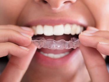 my community dental
