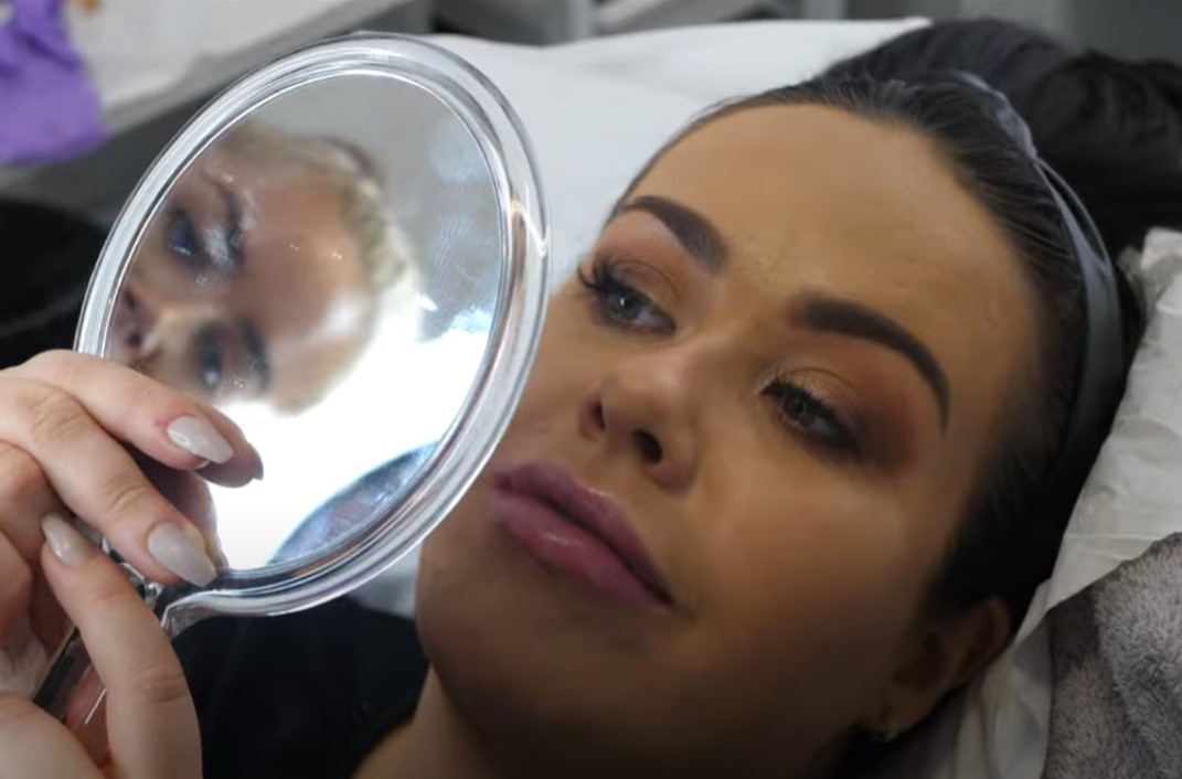 How much should I pay for lip fillers?