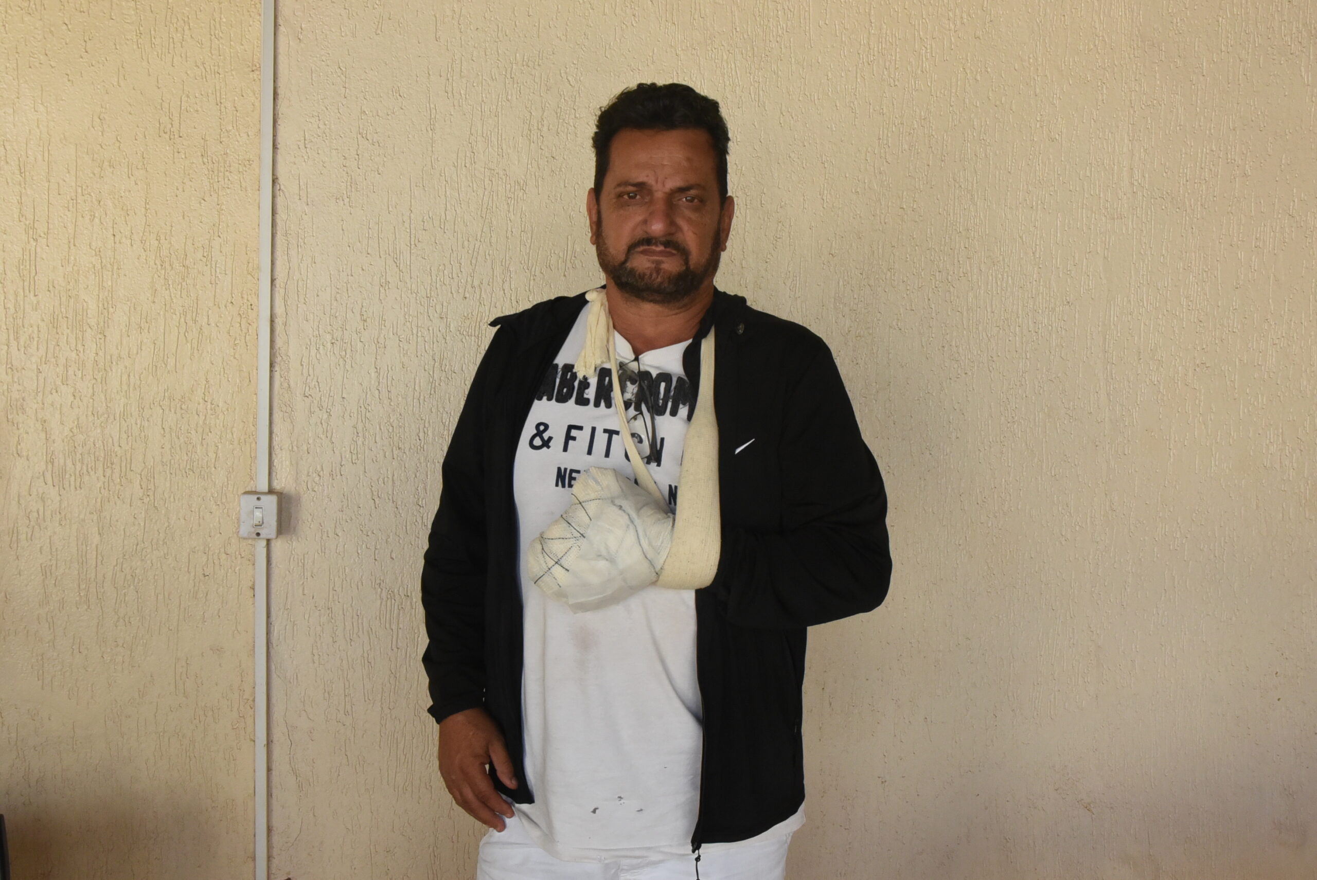 Pintor que teve mão mutilada por artefato fala pela primeira vez após incidente  