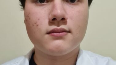 Saúde na mesa: Manteiga ou margarina?