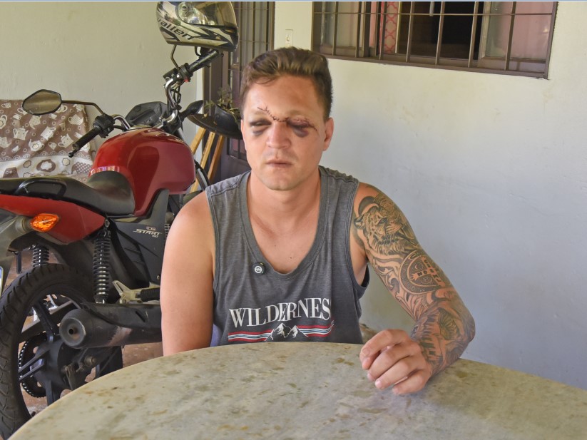 Motociclista leva 26 pontos após ser atingido por linha de cerol em avenida de  Barretos