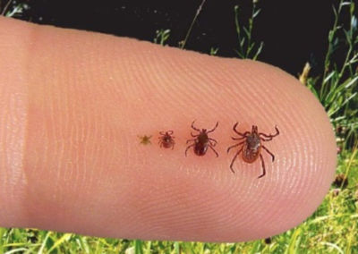 Responding to Cases of Rocky Mountain Spotted Fever in California, USA