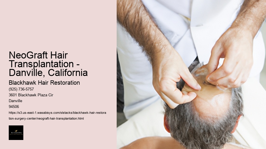 NeoGraft Hair Transplantation - Danville, California