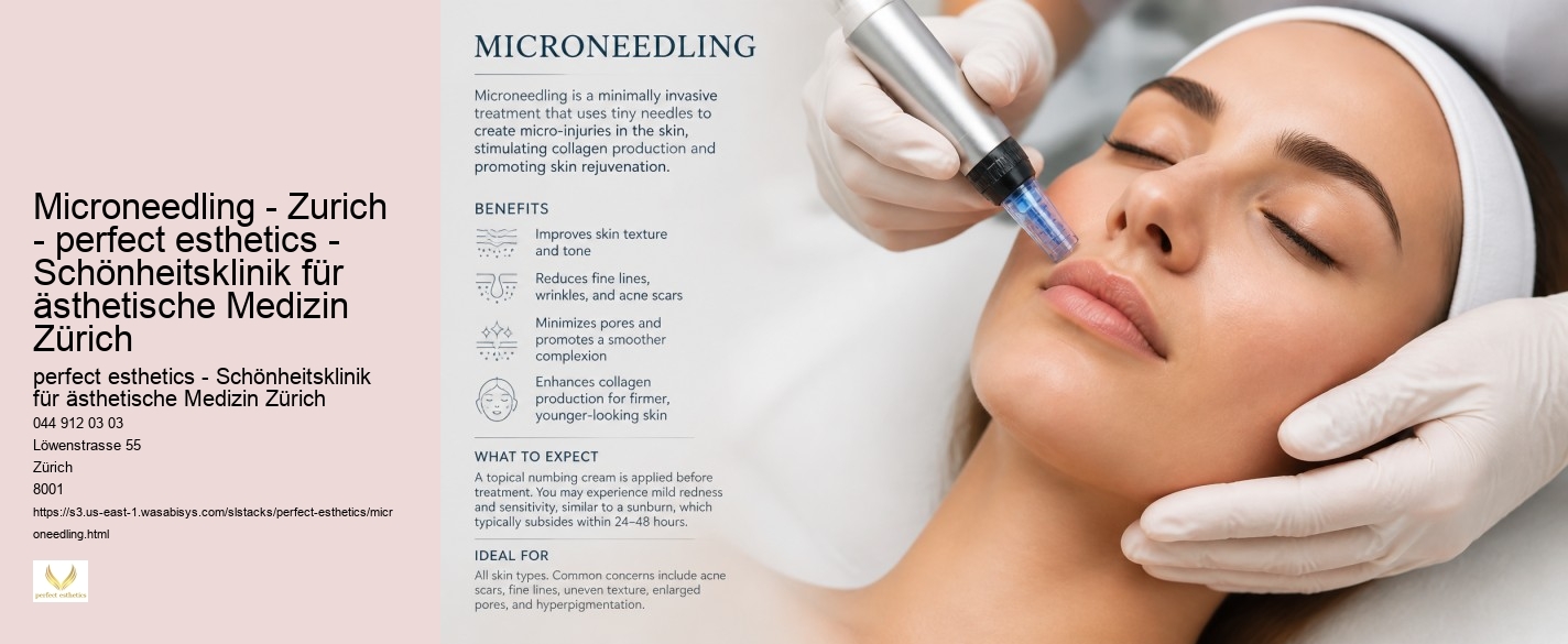 Microneedling - Zurich - perfect esthetics - Schönheitsklinik für ästhetische Medizin Zürich perfect esthetics - Schönheitsklinik für ästhetische Medizin Zürich Microneedling - Zurich - perfect esthetics - Schönheitsklinik für ästhetische Medizin Zürich