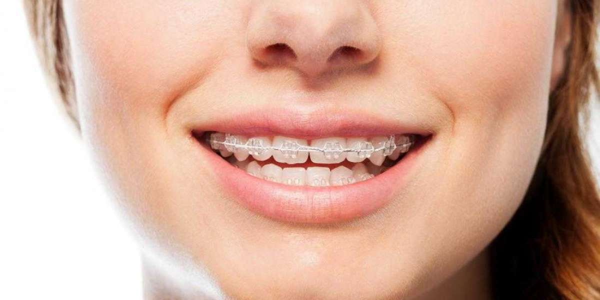 All you need to know about Orthodontic Care