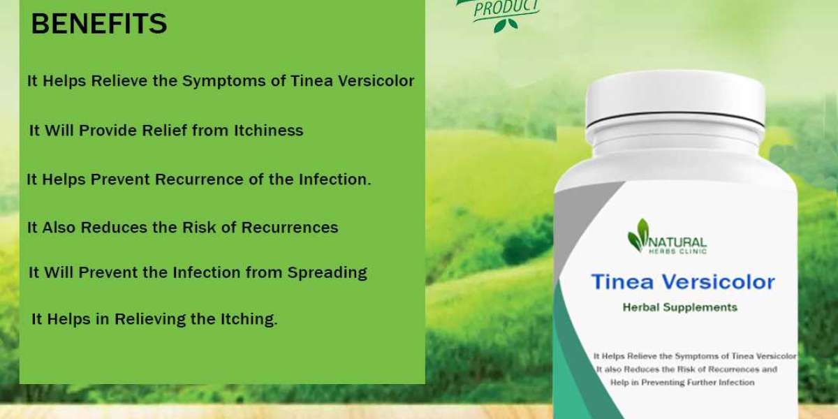 Tinea Versicolor Try Home Remedies to Resolve the Skin Problem