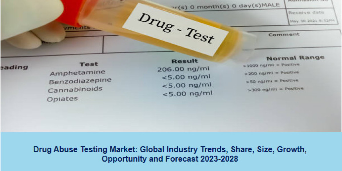 Drug Abuse Testing Market Trends | Forecast 2023-2028
