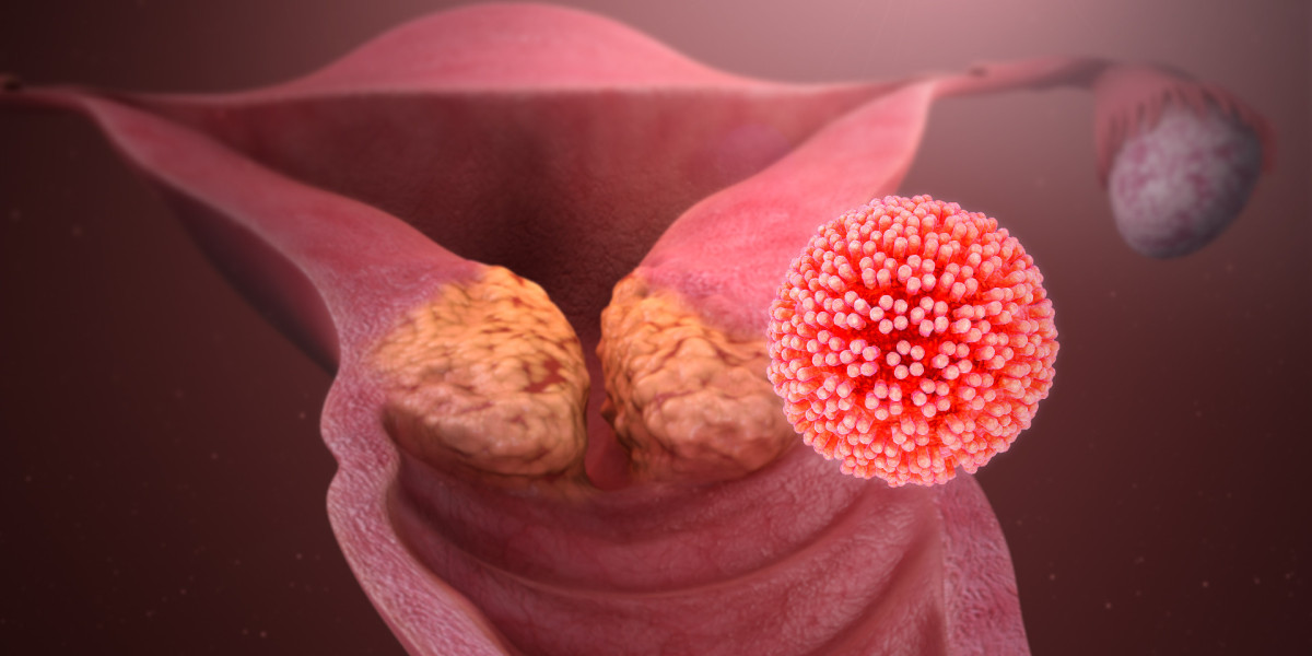 HPV's Role In Cervical Cancer Recognized In Guideline Changes