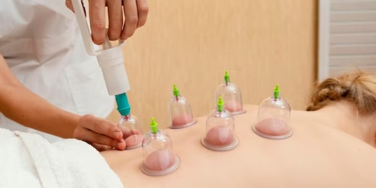 Revealing the Therapeutic Potential: Moxibustion Treatment in Singapore