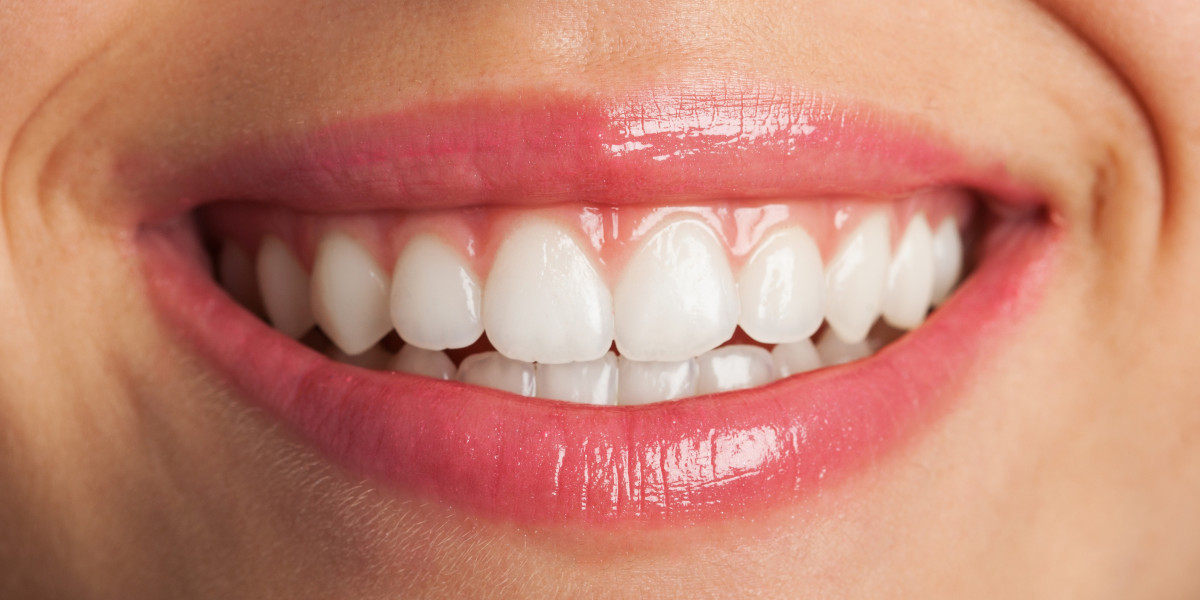 Perfecting Smiles Cosmetic Dentistry in Richmond