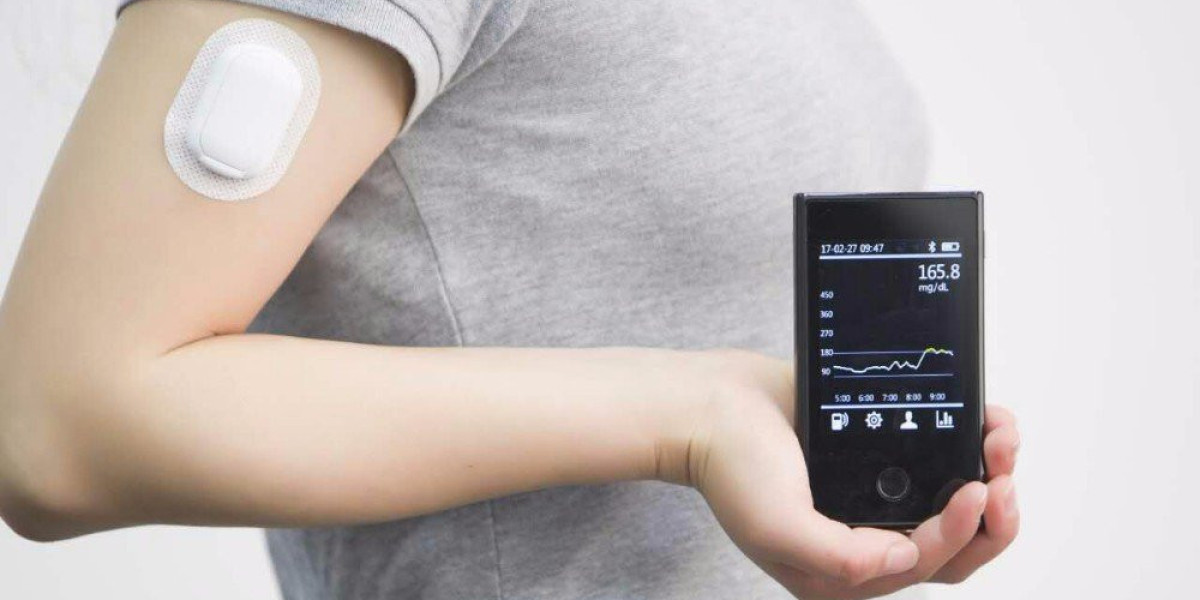 Continuous Glucose Monitoring Market: A Regional Look at UK, Germany, South Korea & France (2024)