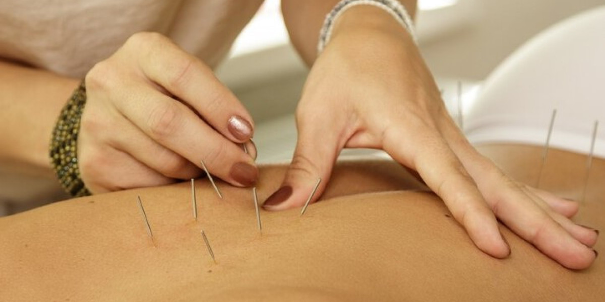 Harnessing Appetite: Acupuncture's Role in Weight Wellness