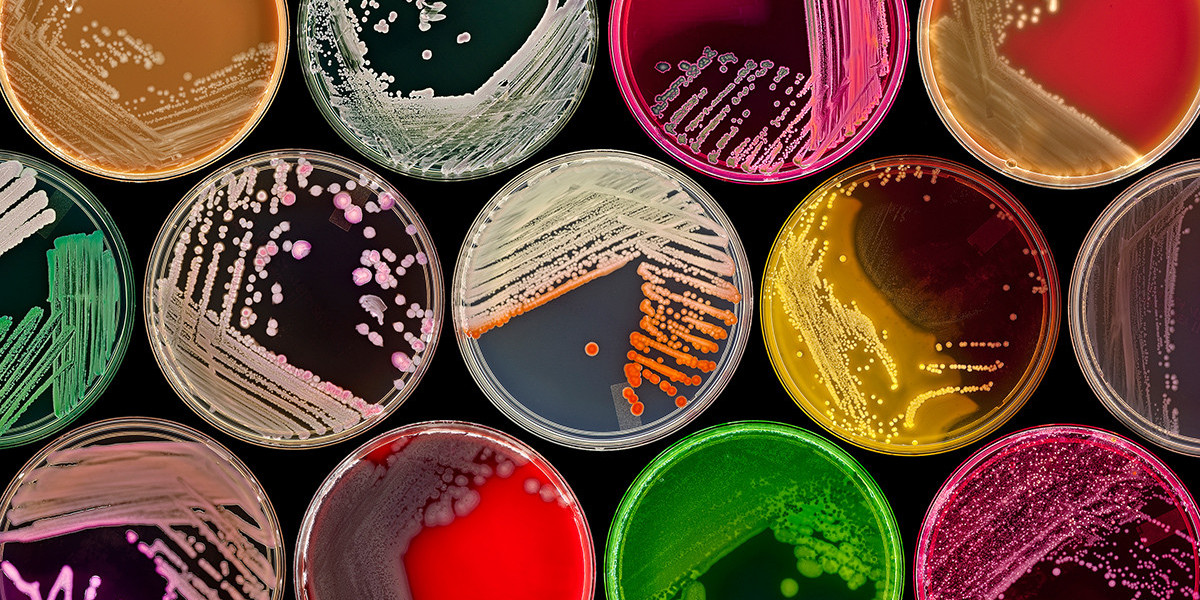 Microbial Products Market Booms Globally: US, UK, France, S. Korea Lead Growth (2024)