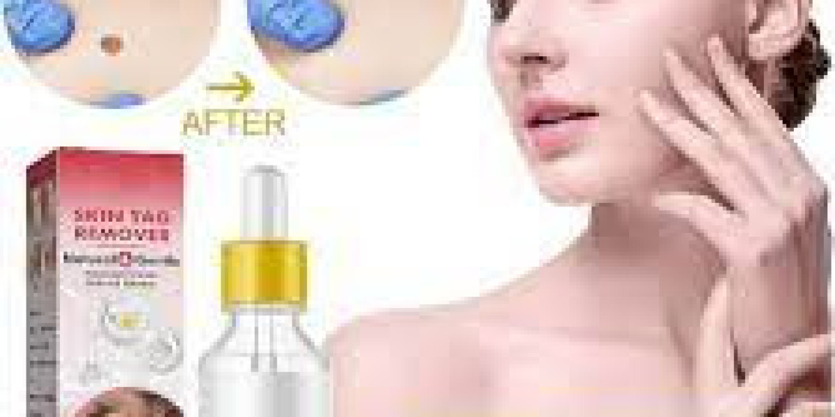 https://sites.google.com/view/lux-skin-tag-remover-review/home