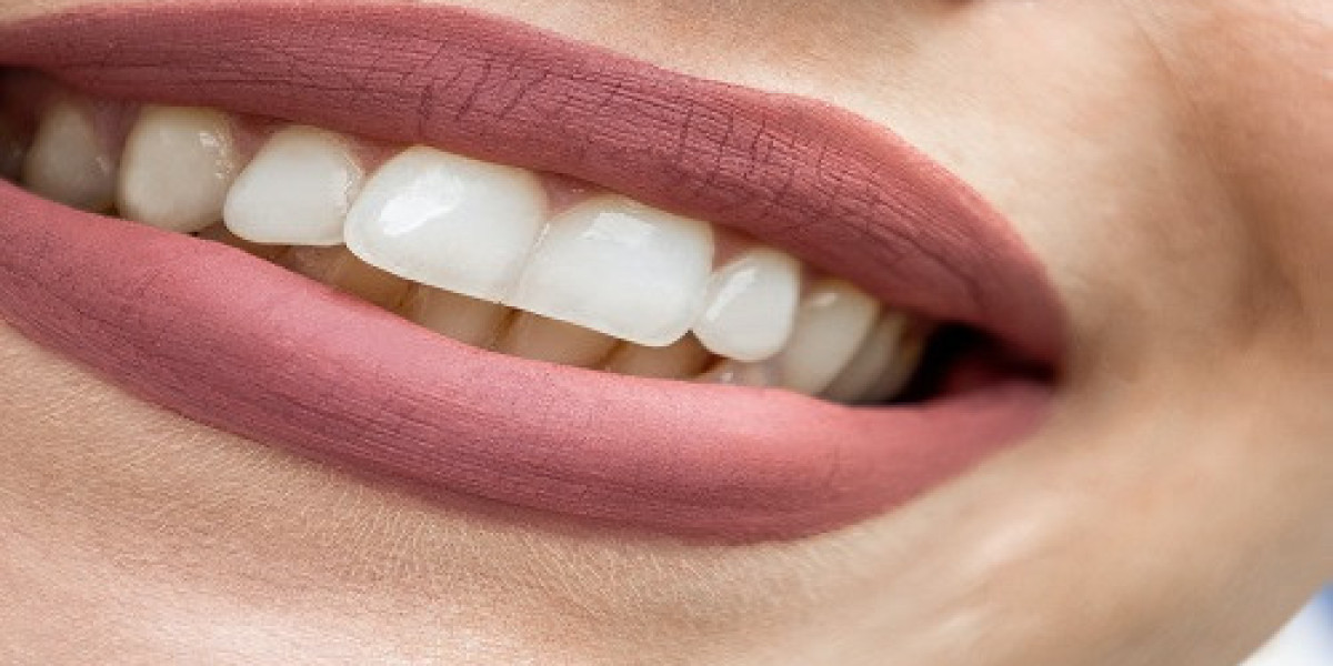 Teeth Whitening Trends: The Latest Innovations for a Brighter Smile