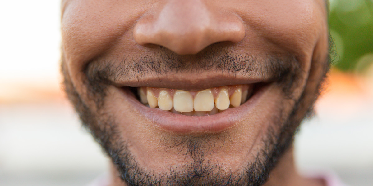 8 Surprising Health Benefits of Straight Teeth